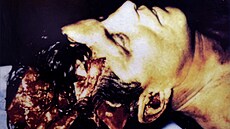T�lo prezidenta Kennedyho v nemocnici po atentátu (22. listopadu 1963)