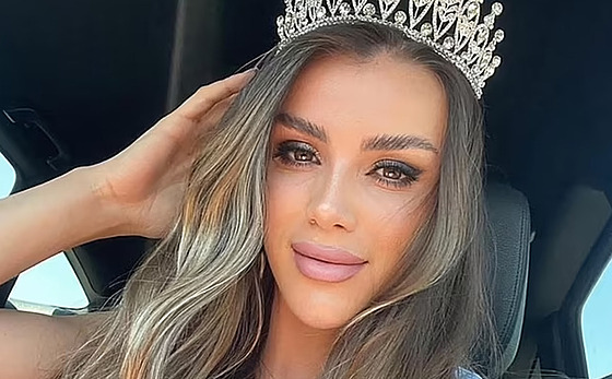 Miss Europe-Kosovo Guler Erdoganová tragicky zem�ela ve 27 letech. (duben 2025)