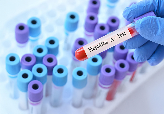 Epidemii žloutenky A se v Praze nedaří zastavit, roste zájem o očkování