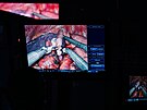 Olomouck fakultn nemocnice si podila druh robotick operan systm da...