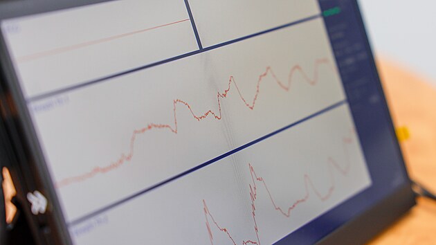 Vyvjen triko se senzory me snit poet dopravnch nehod zpsobench navou. (14. dubna 2025)