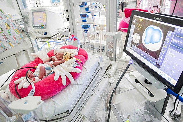 Nový pístroj, který ve zlínské porodnici pomáhá s monitorováním dechových...