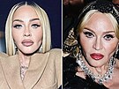 Zpvaka Madonna se snaí vemi prostedky zastavit stárnutí. Na Instagramu...