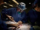 Ameri�tí léka�i poprvé úsp�n� dali ledvinu z geneticky upraveného prasete...