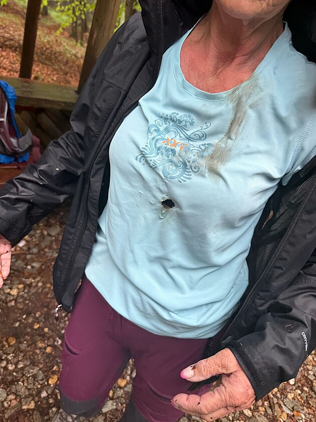 Kdy zásah blesku zpsobil turistm popáleniny v oblasti hrudníku, v obleení...