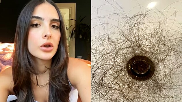 Sophia Umansky se sv��ila na TikToku s tím, �e poté, co za�ala s aplikováním...