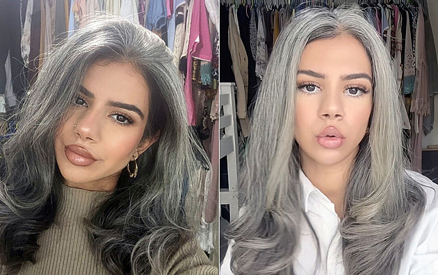 Šedivět začala už ve třinácti, dnes je díky vzhledu žena hvězdou