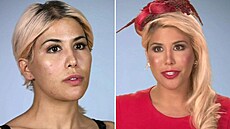 Cht�la vypadat jako její ikona, tak se �ena nechala n�kolikrát operovat.