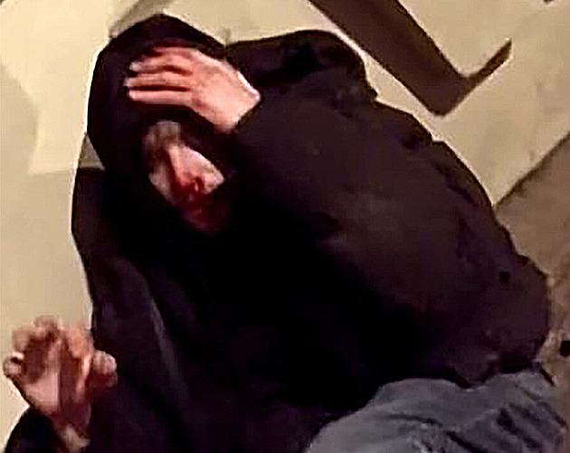 Zkrvavený obličej a ruka chránící hlavu. Policie hledá oběť agresivního lupiče