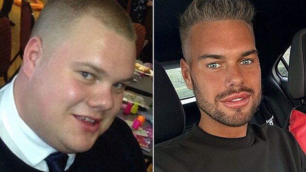 Mu� se d�ky plastik�m radik�ln� prom�nil.