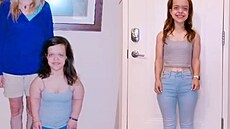 Chandler Crewsová si splnila sen o prodlou�ených nohách.