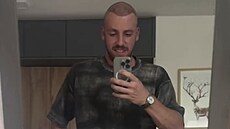 Martin Prágr byl na transplantaci vlas.