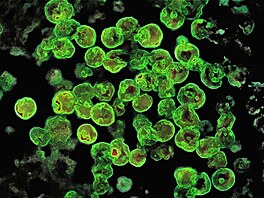 Parazit Naegleria fowleri pod mikroskopem (23. ledna 2023)