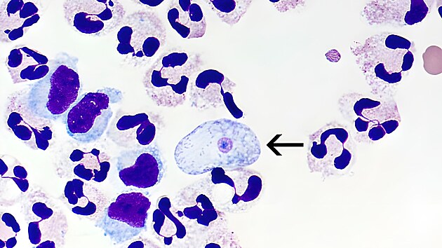 Parazit Naegleria fowleri v mozkomnm moku pod mikroskopem (23. ledna 2023)