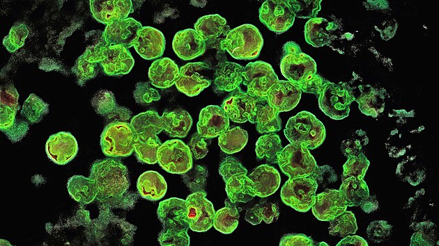 Parazit Naegleria fowleri pod mikroskopem (23. ledna 2023)