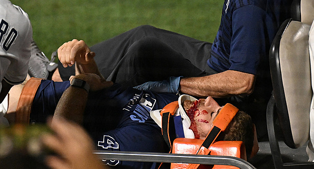 Baseballistu trefil odpal přímo do obličeje, zakrváceného ho odvezli na nosítkách