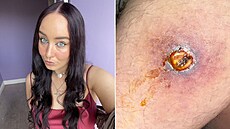 Paige si kv�li pokousání od pavouka pro�ila peklo.