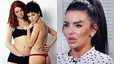 Tmavovláska Julia Volkovová z dua Tatu oslavila tyicítku. Kvli plastikám a...