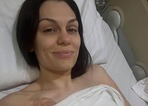 Zpvaka Jessie J po mastektomii (erven 2025)