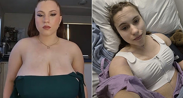 Poprsí jí museli přidržovat, po zmenšení se žena cítí jako znovuzrozená