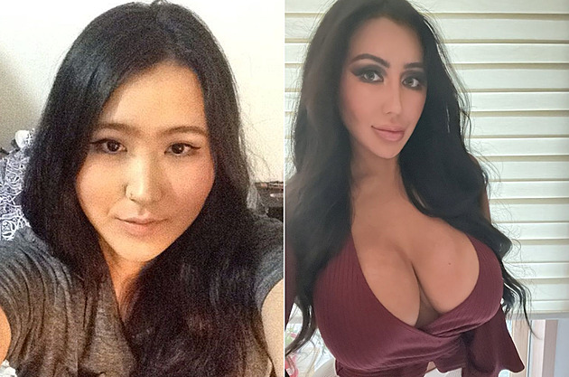 Žena toužila po vzhledu Kim Kardashianové, tak se nechala přeoperovat