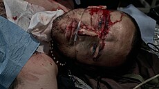 Oetování zranného ukrajinského vojáka nedaleko Pokrovsku (20. ervence 2025)...