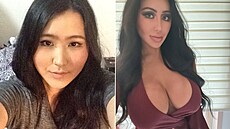 Chtla vypadat jako Kim Kardashianová, tak vsadila na plastiky.