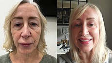 ena má za sebou úasnou promnu.