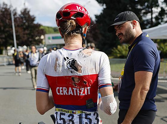 Potluená eská cyklistka Kristýna Burlová po pádech v páté etap enské Tour...