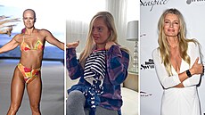 Star�í modelky, modelka s alopecií, s Downovým syndromem i s kily navíc. Sports...
