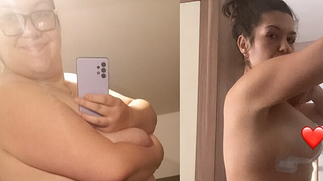 Barbora Dem�terov� zhubla v po�adu Extr�mn� prom�ny za rok ze 126 kilo na 70.