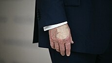 Americký prezident Donald Trump pitáhl pozornost velkou skvrnou make-upu na...