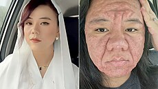 �ena v t�hotenství kv�li vzhledu trp�la.