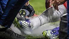 Na bolavý kotník Ivana Schranze léka stíká chladivý sprej, slávistovi lápl...