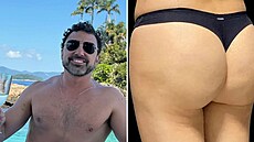 Léka si íká král celulitidy.