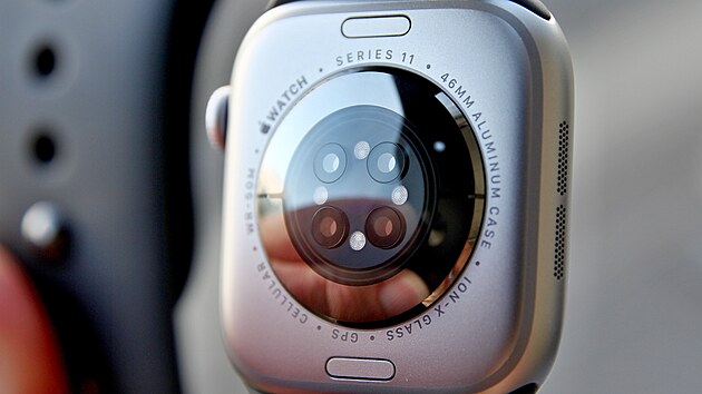 Apple Watch Series 11