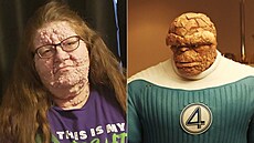 ena je kvli svému vzhledu velmi neastná.