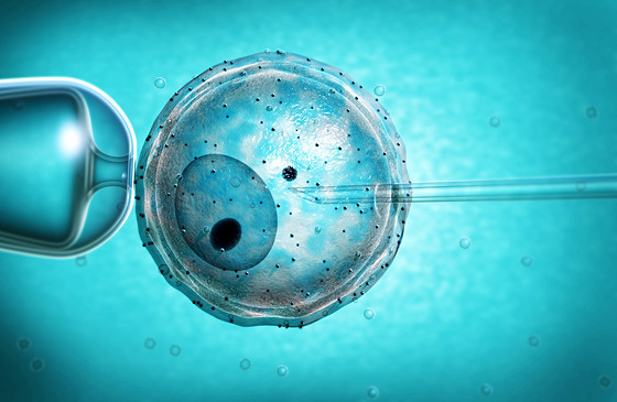 ICSI je metoda, kdy se spermie píchne pímo do vajíka. To zvyuje u mnoha pár...