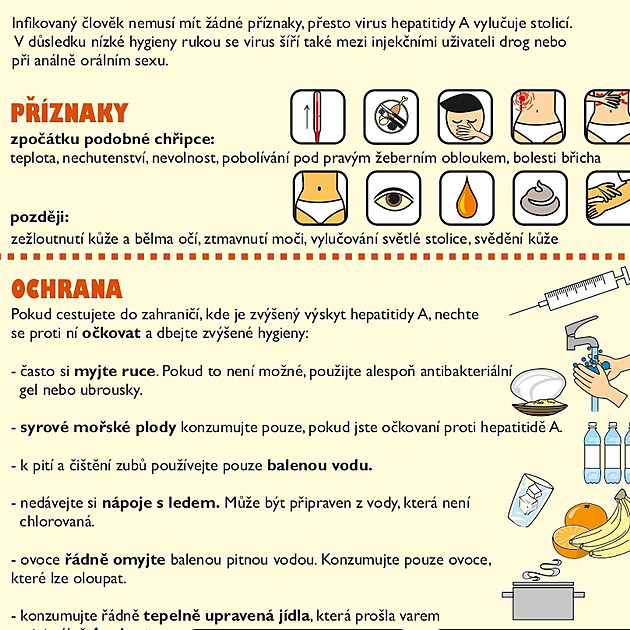 Praha hlásí za týden dalších 40 případů žloutenky. Začne jako viróza, končí v IKEM