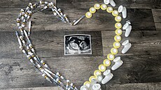 Toto ve me být teba pi cest za vysnným miminkem. Foto od klientky