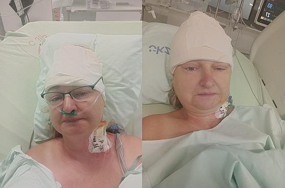 Jaroslava Aulická od loska bojuje s agresivním nádorem mozku - glioblastomem....