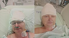 Jaroslava Aulická od lo�ska bojuje s agresivním nádorem mozku - glioblastomem....