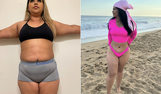 �ena má za sebou prom�nu, na kterou �ekala roky.