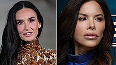 Slavné eny, které si oblíbily proceduru, bhem které je chirurgové zbavují...