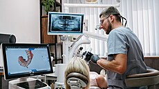 Díky navigované implantaci je zákrok etrnjí a hojení rychlejí.