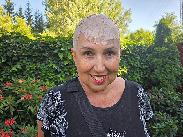 Žena bojuje se zákeřným nádorem mozku. Lidé ji na léčbu poslali miliony