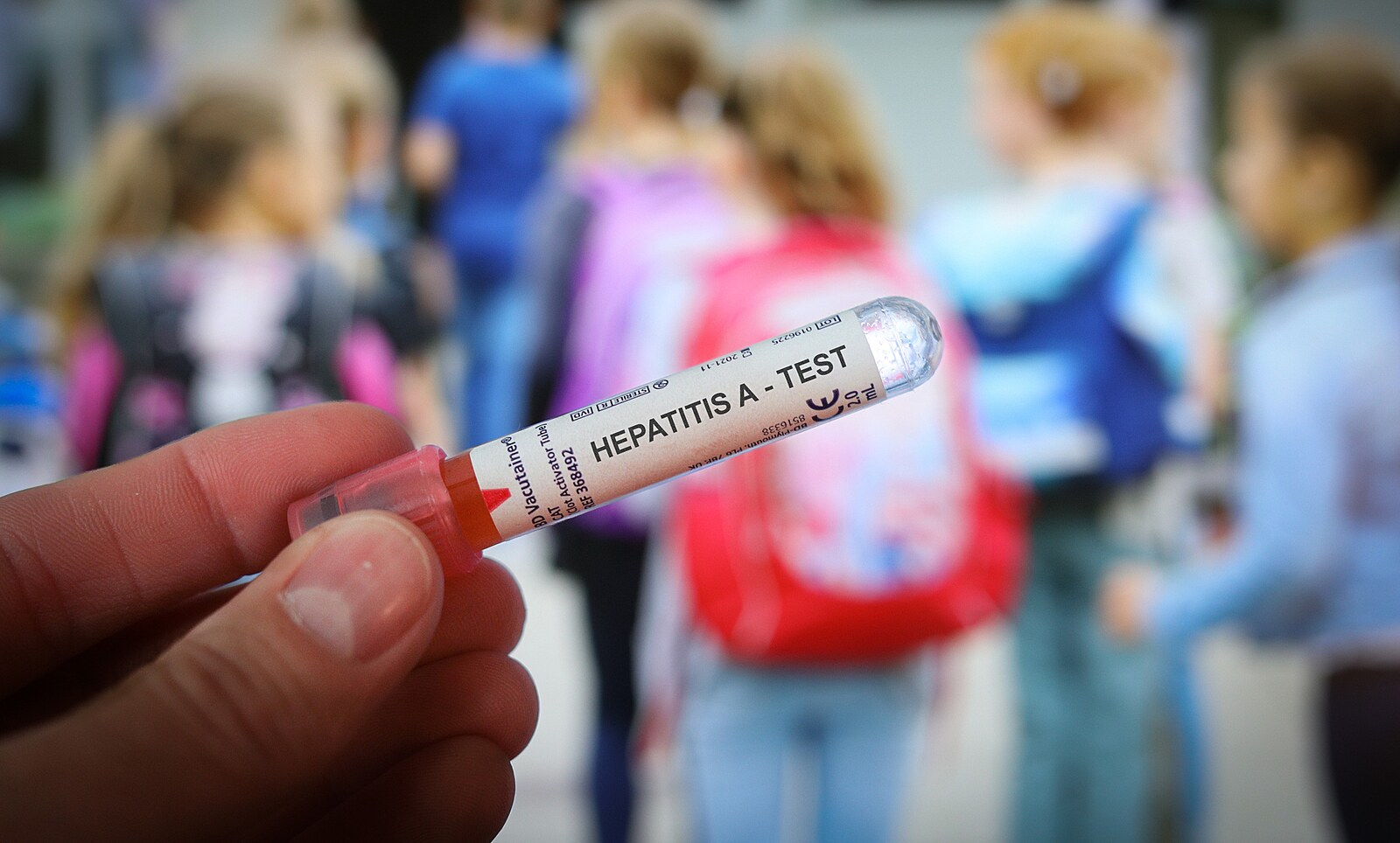 Restaurace uzavřená kvůli žloutence je opět v provozu, onemocnělo devět lidí