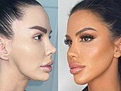 ena touila po dokonalém vzhledu, který na sociálních sítích prezentuje...