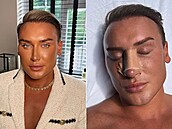 Pes sto invazivních zákrok v oblieji má za sebou mu posedlý vlastním...