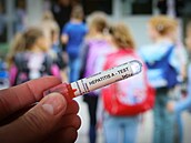 loutenka typu A (ilustraní foto)